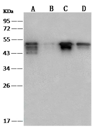 antibody case