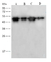 antibody case