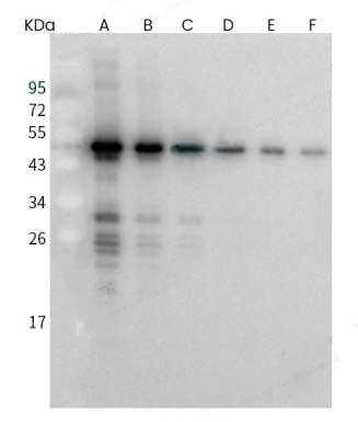 antibody case