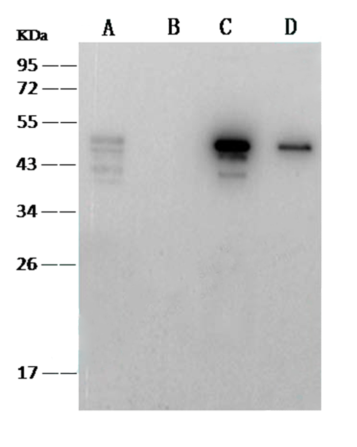 antibody case