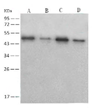 antibody case